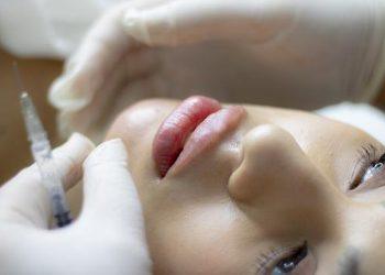 Reasons to Consider a Lip Filler Treatment