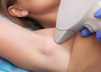 5 benefits of laser hair removal in Manchester