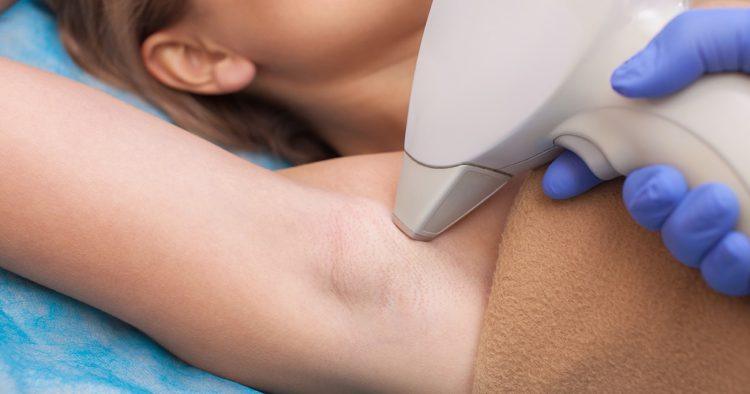 5 benefits of laser hair removal in Manchester