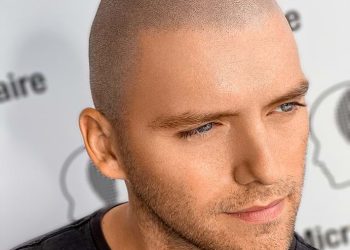 Overcoming Hair Loss: The Role of Scalp Micropigmentation