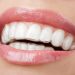 Why Invisalign is the Most Popular Orthodontic Treatment