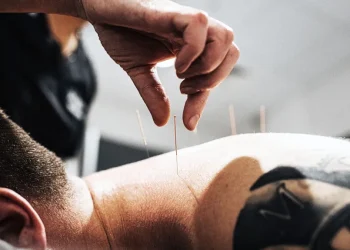 Unleashing Holistic Healing: The Benefits of Choosing Acupuncture in Chelsea