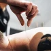 Unleashing Holistic Healing: The Benefits of Choosing Acupuncture in Chelsea
