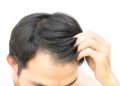 Personalized Solutions for Hair Restoration: Finding the Right Treatment for You