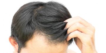 Personalized Solutions for Hair Restoration: Finding the Right Treatment for You