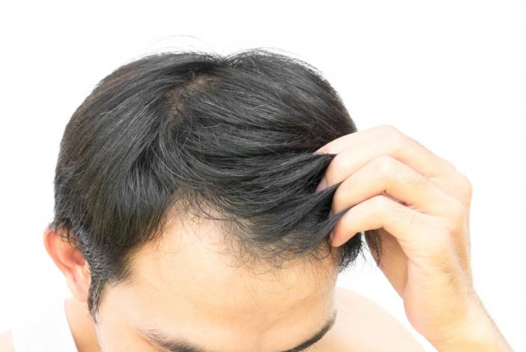 Personalized Solutions for Hair Restoration: Finding the Right Treatment for You