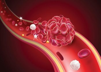 Supporting Life-Saving Initiatives: The Critical Role of Blood Clot Charities